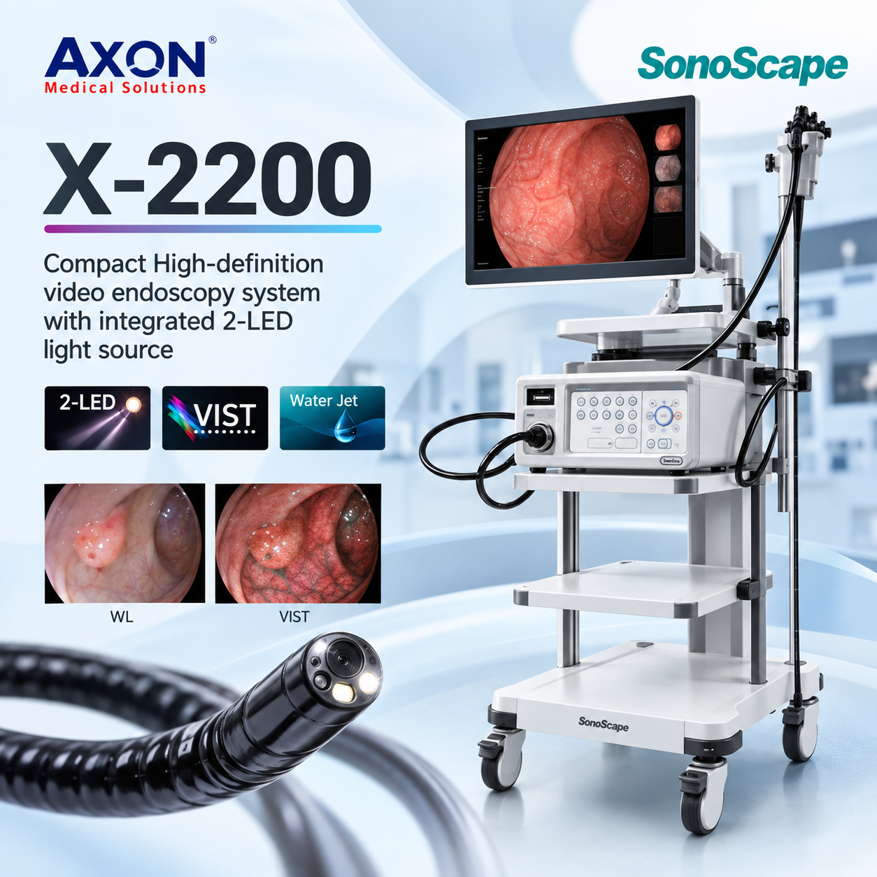 High-definition video endoscopy system x2200 Sonoscape