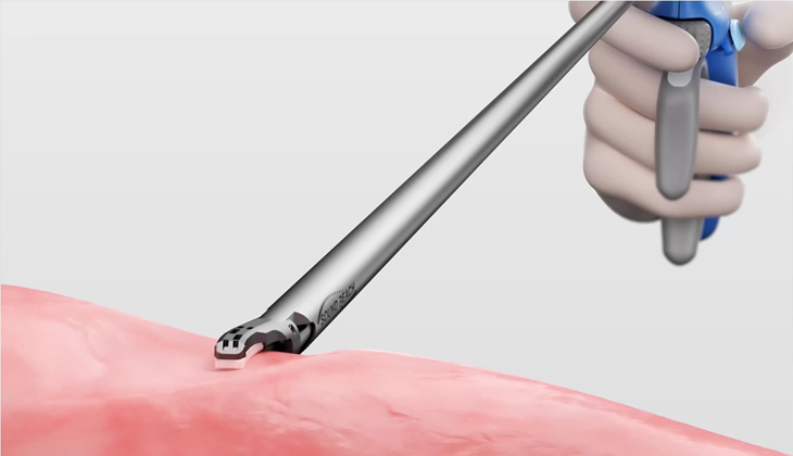 OPTISEAL Vessel Sealer & Divider SRB Series Ultrasonic Shears