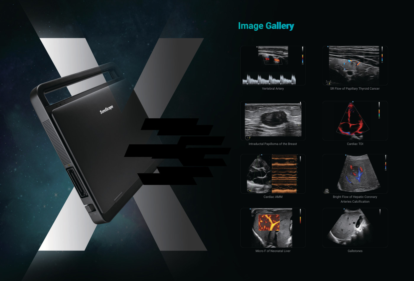 X11 ultrasound image gallery