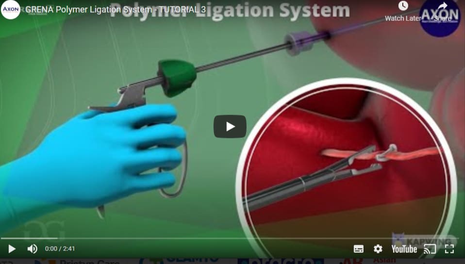 Polymer ligation system